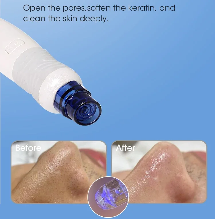 Hot Selling Spa Use Hydroderma - đánh giá và giá Hydro Facial Machine 7 In 1