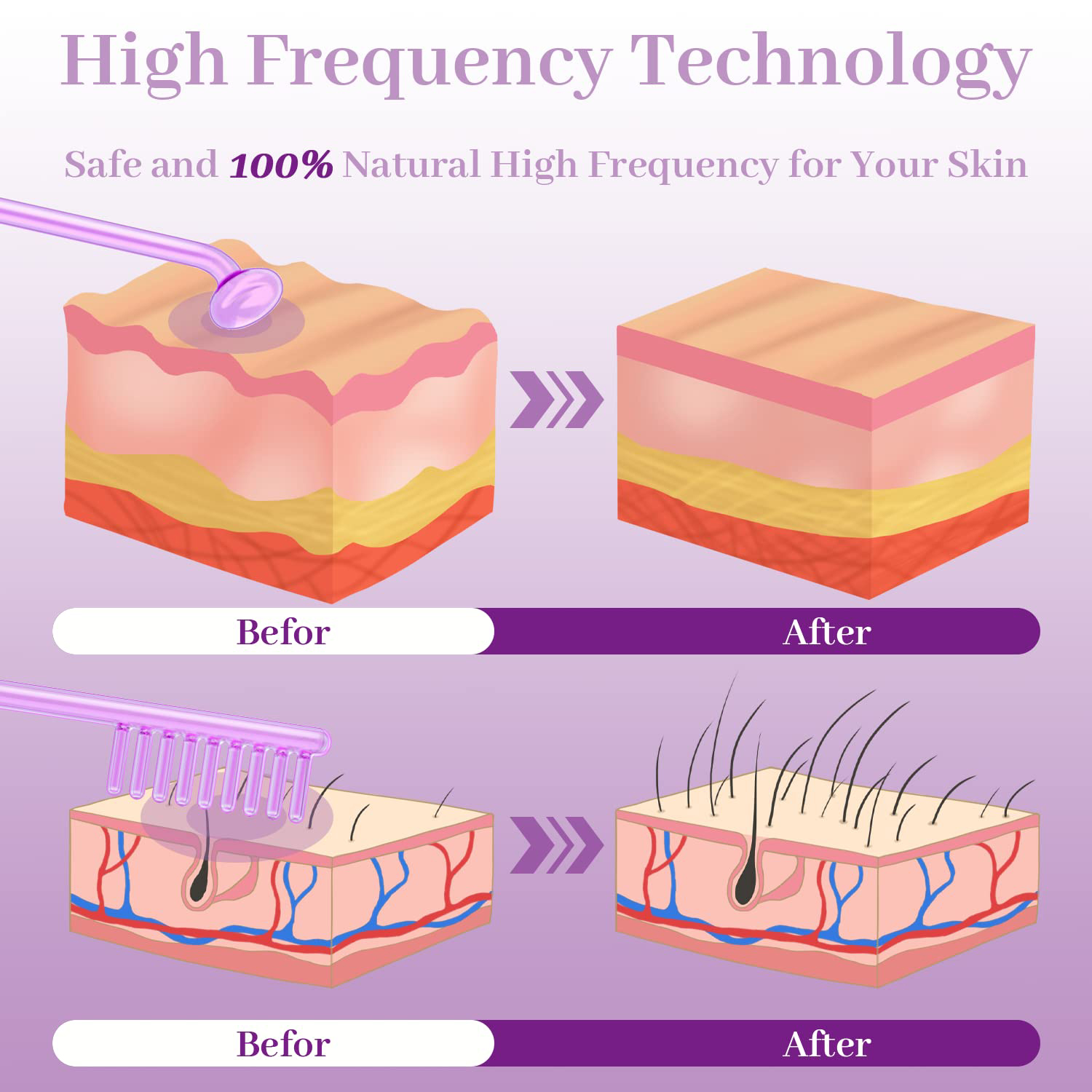 4in1 High Frequency Electrode  - đánh giá và giá High Frequency Wand Facial Machine Neon