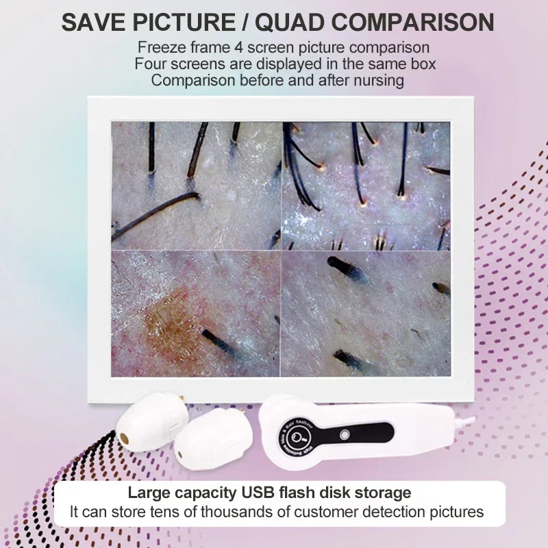 2025 HD Digital Skin Analyzer  - đánh giá và giá Skin Moisture Analyzer Digital Detector