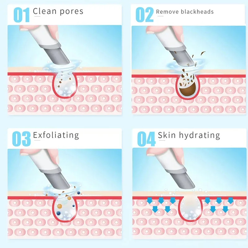 NEW Peeling Beauty Device New  - đánh giá và giá Hydra Dermabrasion Aqua Peel Machine