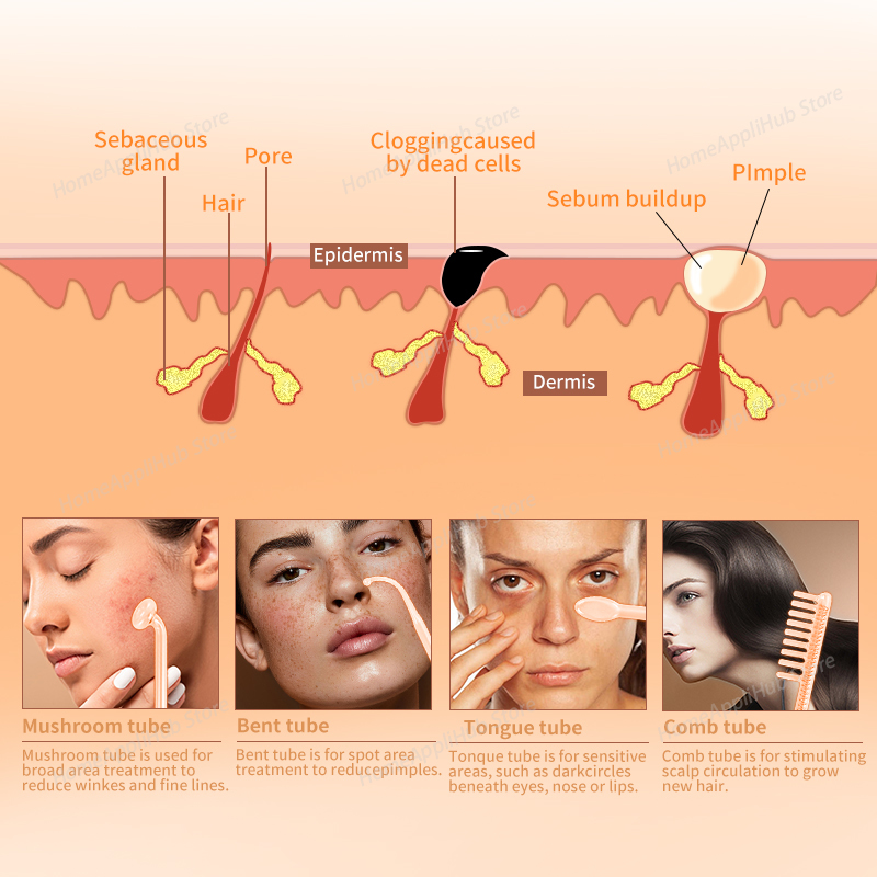 Darsonval Portable High Freque - đánh giá và giá High Frequency Wand Facial Machine Neon