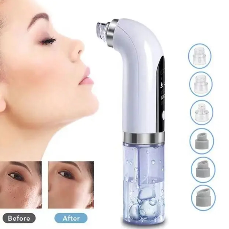 Deep-cleaning handheld blackhe - đánh giá và giá Blackhead Remover Vacuum Suction