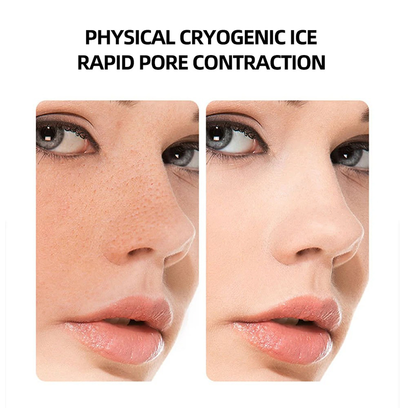 Hot Cold Hammer Home Facial Ma - đánh giá và giá Cold Warm Hammer Facial Machine