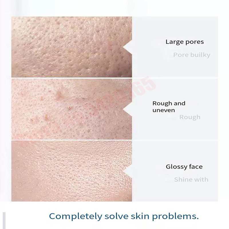 Hydra Serum Solution Facial De - đánh giá và giá Hydra Dermabrasion Aqua Peel Machine