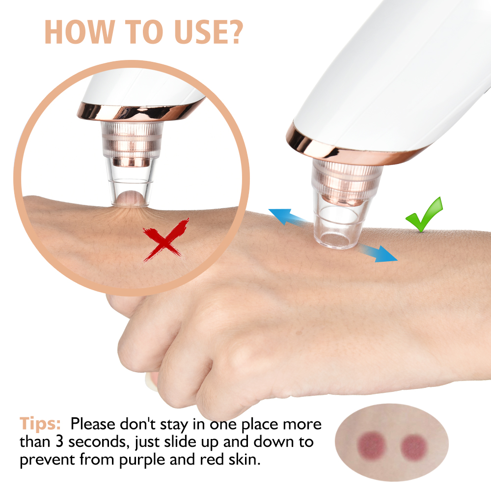 Mụn Đầu Đen Vacosi Pore Cleane - đánh giá và giá Blackhead Remover Vacuum Suction