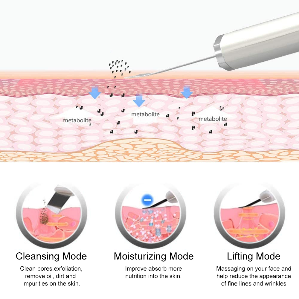 Ultrasonic Skin Scrubber & Vac - đánh giá và giá Blackhead Remover Vacuum Suction