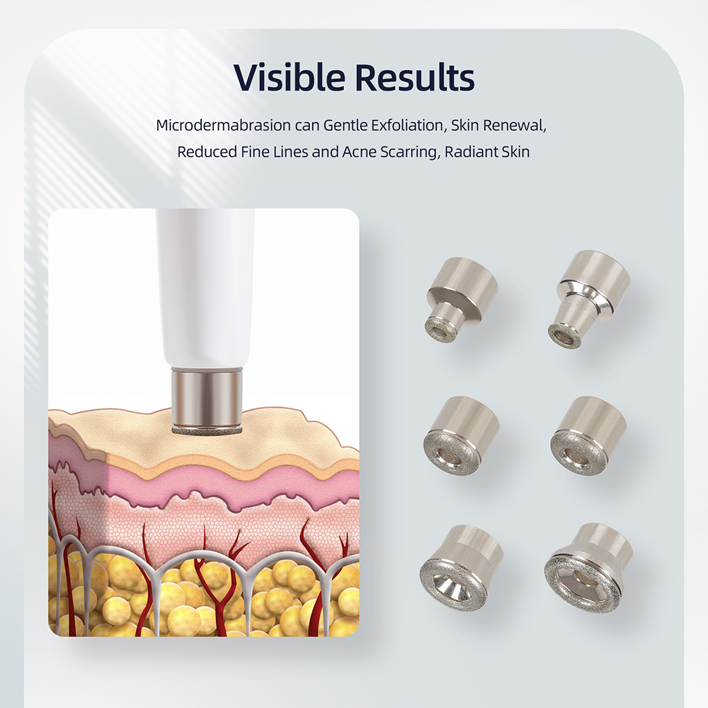 3-in-1 Diamond Microdermabrasi - đánh giá và giá Diamond Microdermabrasion Machine 3 In 1