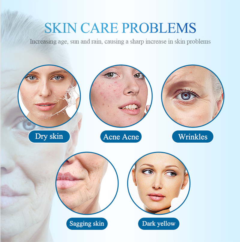 NEW Skin Peeling Oxygen Facial - đánh giá và giá Diamond Microdermabrasion Machine 3 In 1